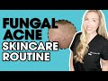 Fungal Acne Skincare Routine | Must-have Products! | The Budget Dermatologist