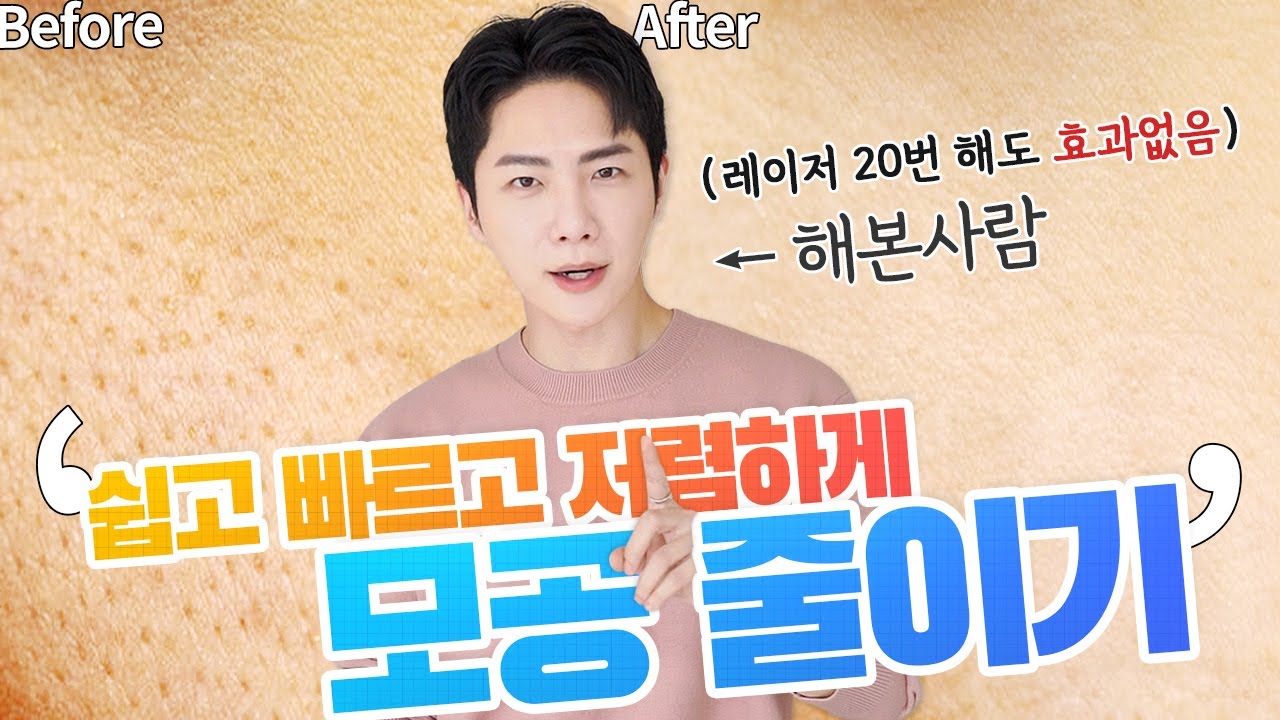 집에서 모공 줄이는 법 (시술 X) + 추천템