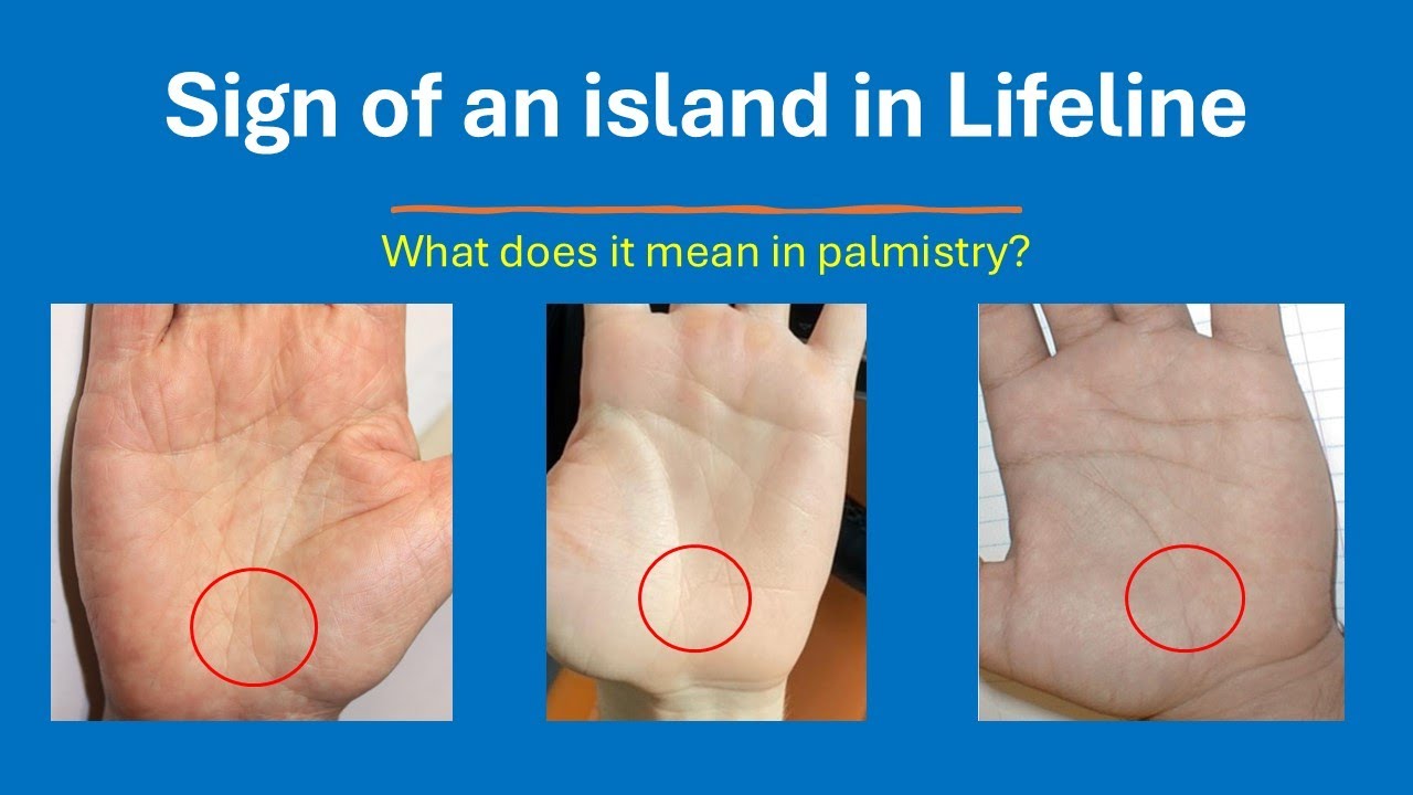 Island in Lifeline | Palm reading | Lifeline | Island on Lifeline | Palmistry | Hand reading