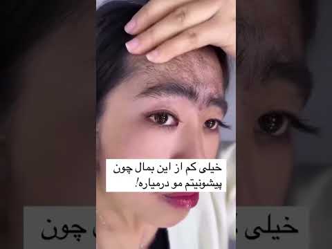 درمان ریزش مو هم باید موضعی باشه هم خوراکی تا موقت نباشه ریزش مو ریزش ارثی تغییر مثبت