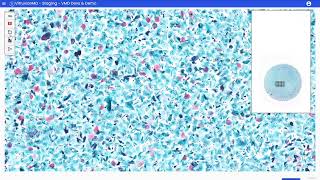 VenusMD – AI-Powered Cervical Cancer Screening