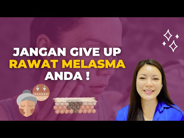 Beauty Tips || Jangan Give Up Rawat Melasma Anda! class=