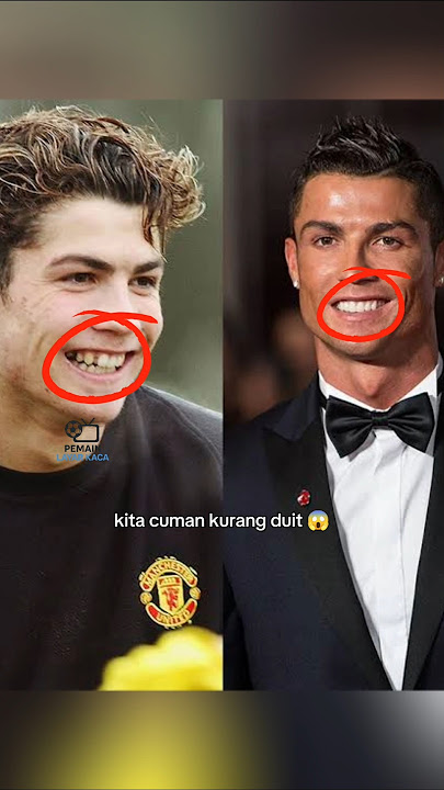 Pemain bola yang rubah penampilannya 😱