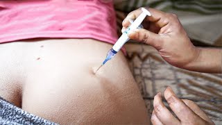 Le Hip Im Injection Technique Safe Ocks Injection Step By Step Nurse Training Guide