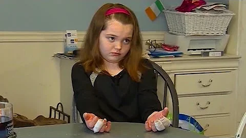 Girl suffers third-degree burns making homemade sl...