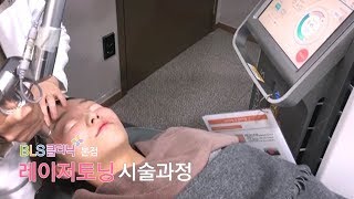 레이저토닝 시술 과정 BLS클리닉 본점