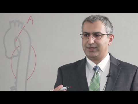 TAMBE: A Promising Treatment for Aortic Aneurysm