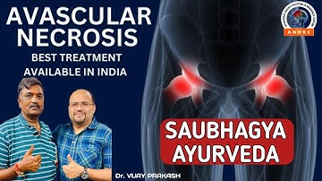 A Great Message to South Indian AVN Patients | Try AVN Treatment Without Surgery | Dr. Vijay Prakash