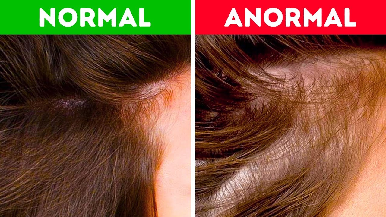 yaratıcılık kuralları boşverin Saçlarınız Sağlığınız Hakkında Neler Söyler