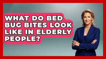 What Do Bed Bug Bites Look Like In Elderly People? - Insects and Invaders