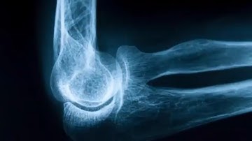 The first X-rays in color and 3D