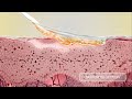 Biatain Silicone La Technologie 3DFit D Un Pansement Qui S Adapte Parfaitement Au Lit De La Plaie Biatain Silicone La Technologie 3DFit D Un Pansement Qui S Adapte Parfaitement Au Lit De La Plaie