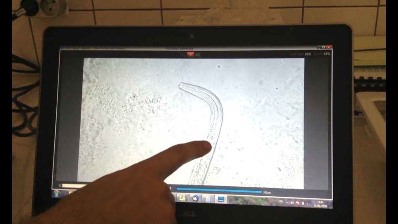 Comment observer les nématodes de vos sols ? Jean Trap, Madagascar