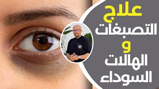 علاج التصبغات والهالات السوداء الدكتور عماد ميزاب Docteur Imad Mizab