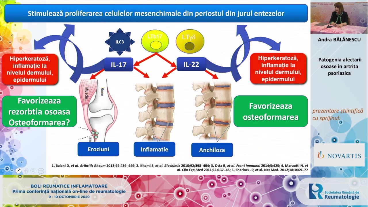 Reumatologia si bolile reumatice