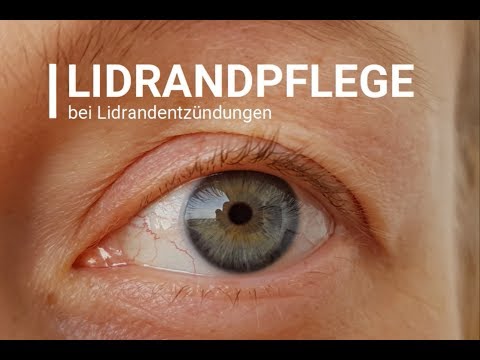 Lidrandpflege bei Lidrandentzündungen und trockenem Auge