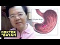 KABAG at ULCER: Masakit na Sikmura -  ni Doc Willie at Liza Ong #297c