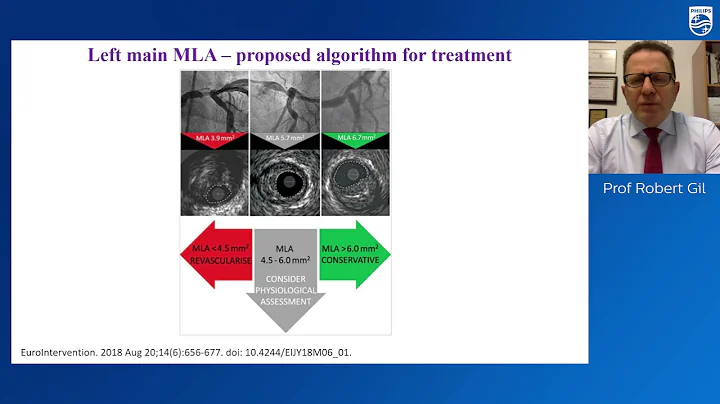 Webinar: How to Perform PCI in Coronary Bifurcation Lesions in 2021