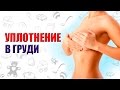 УПЛОТНЕНИЕ В МОЛОЧНОЙ ЖЕЛЕЗЕ. ЛАКТОСТАЗ. КАК РАСЦЕДИТЬ ЛАКТОСТАЗ