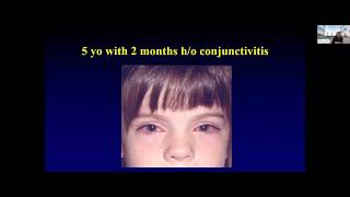 Pediatric Eye Disease & Myopia Management: A Clinical Guide for ODs | Insight Vision Center