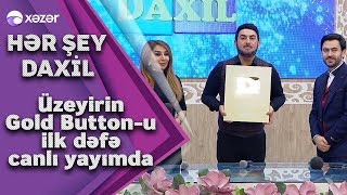 Üzeyirin 1 000000-luq Gold Buttonu Resimi