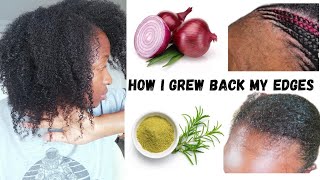 HOW IVE GROWN MY EDGES BACK| TREAT BALD SPOTS IN 4 WEEKS| 3 easy steps thickhair hairgrowth