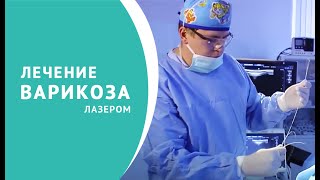 Лечение варикоза лазером во всех подробностях