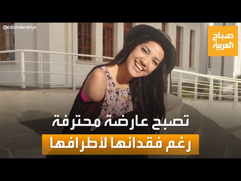فيكتوريا عارضة أزياء مبتورة الذراعين والساق