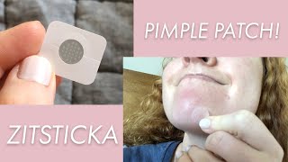 Does ZitSticka Really Work? My Acne Pimple Patch Review