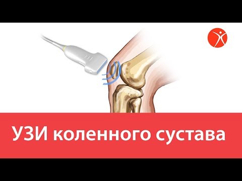 УЗИ коленного сустава