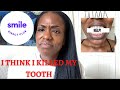 SMILE DIRECT CLUB IS KILLING MY TOOTH | WAS THIS A MISTAKE??!!