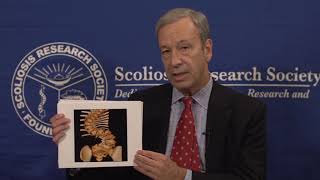 SRS Patient Video: EOS Diagnosis - John Thometz, MD