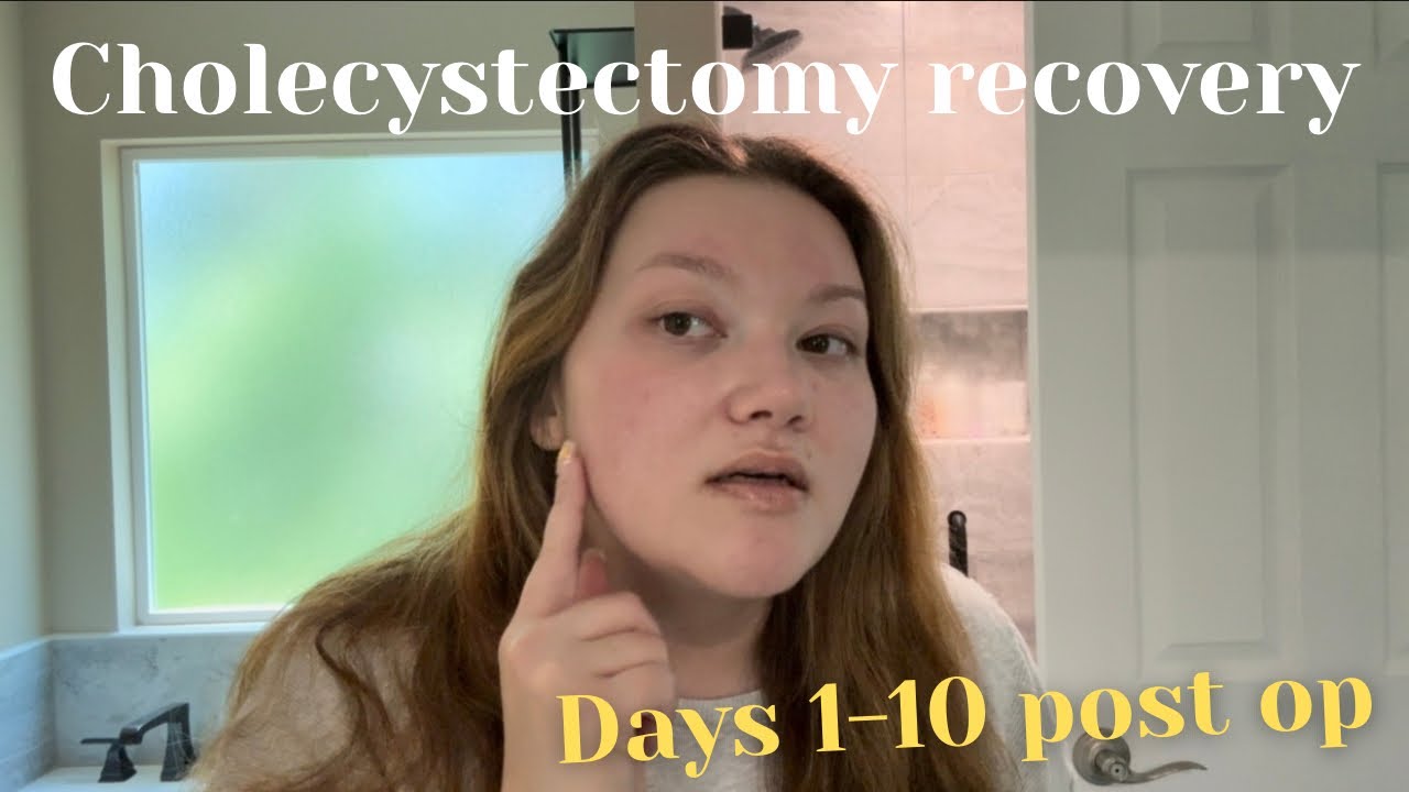 Days 1-10 Post Op | Cholecystectomy Recovery