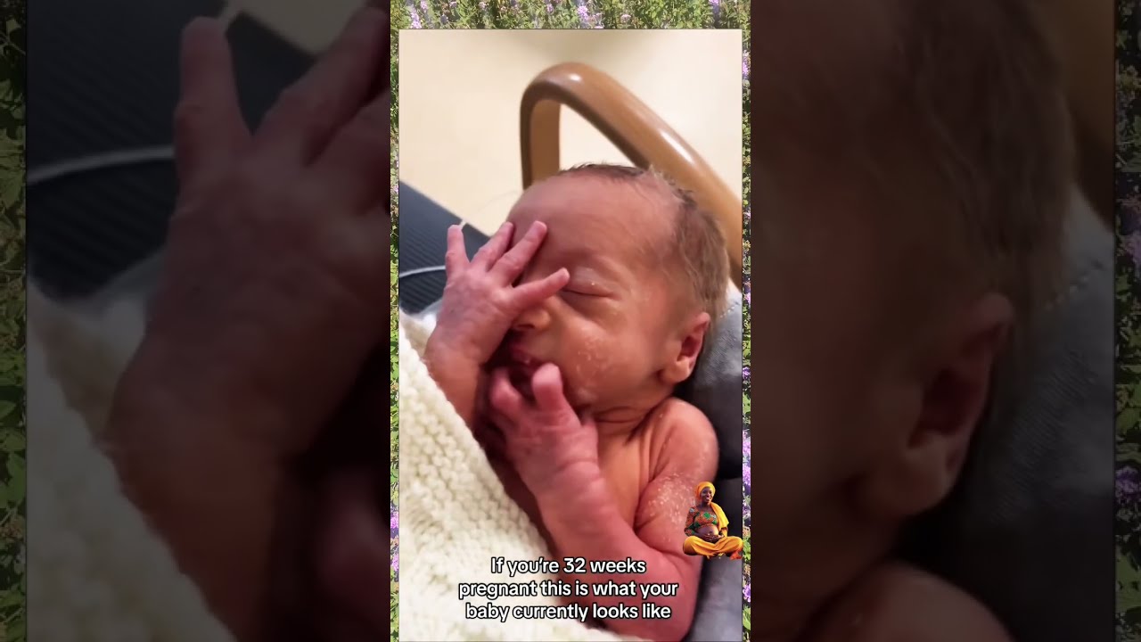 Born At 32 Weeks Shorts Shortsfeed Baby Viralshorts Trendingshorts