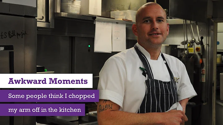 Awkward Moments - Ronnie Murray - I Didn't Chop My...