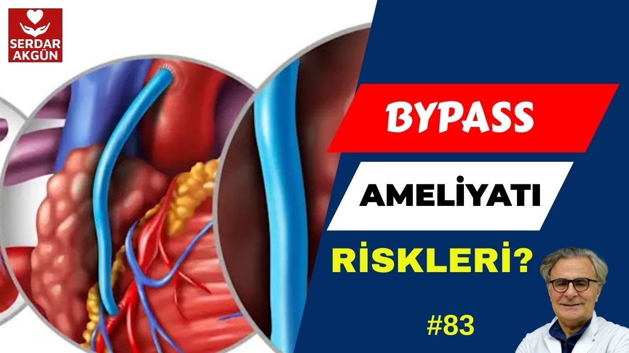 83. Koroner Bypass Ameliyatı, By-pass Riski ve bilmeniz gereken her şey. Serdar Akgün