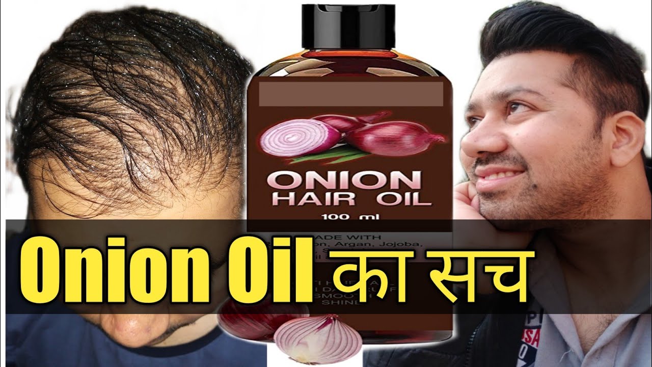 Onion Oil For Hair Growth Review [ Benefits, Results] kya ye sach me
