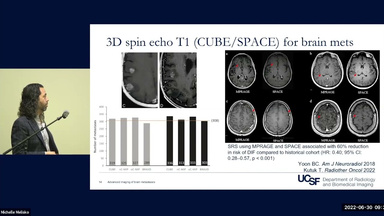 Advanced Imaging in the early detection of brain metastases | Javier ...