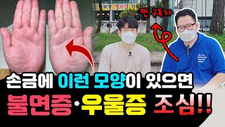 이런 손금은 반드시 조심하세요  불면증 우울증 공황장애를 불러오는 손금
