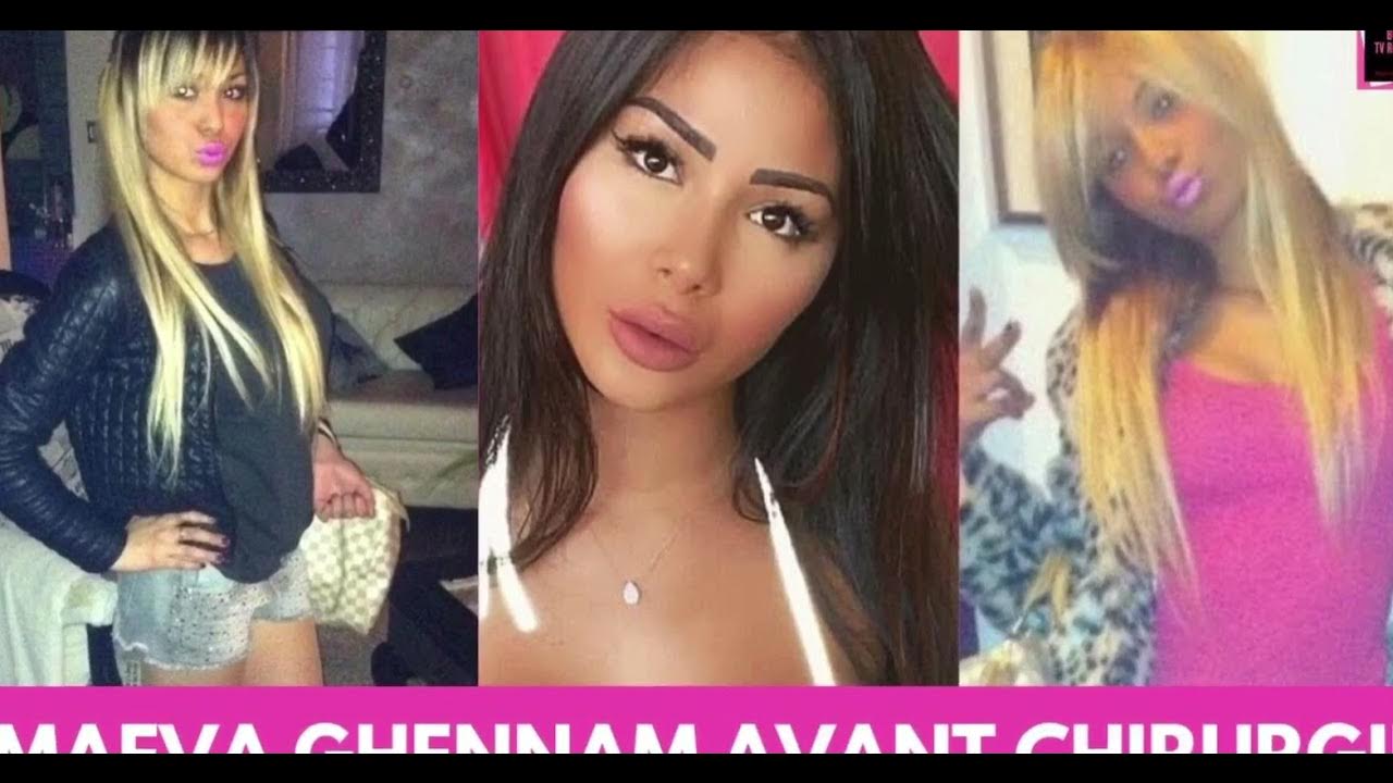 Maéva Ghenam avant chirurgie ! YouTube