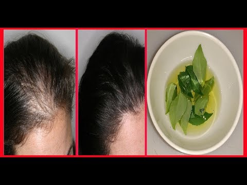 মাথার চুল পরে যাচ্ছে জেনে নিন খুব দ্রুত নতুন চুল গজানোর একটি সহজ টিপস || New Hair Growth Treatment