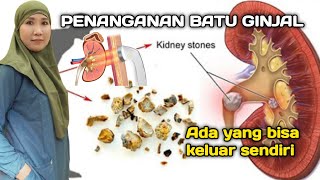Pengobatan BATU GINJAL mulai dari melihat dan pembedahan