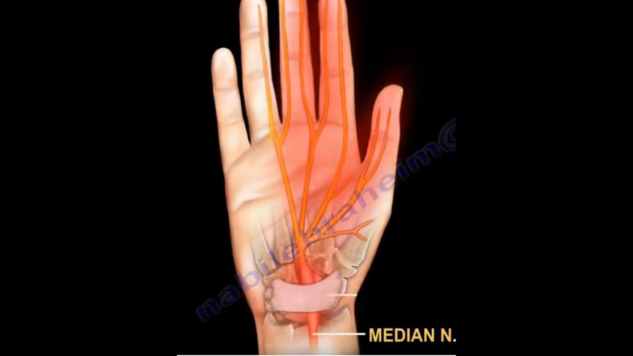 A Patient's Guide to Cubital Tunnel Syndrome - Hand and Upper Limb