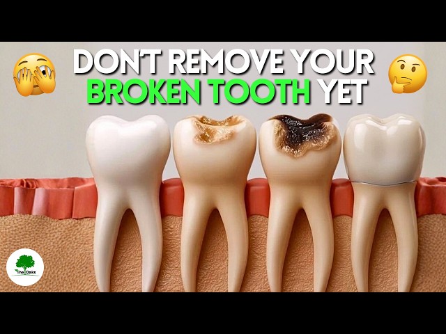 Restore Your Smile with this Dental Treatment | Oaks Dental Clinic 🦷✨