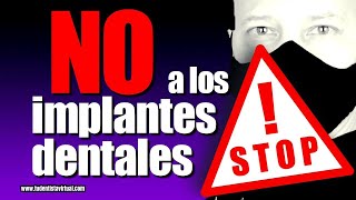 NO CAIGAS EN ESTE ERROR AL REPONER DIENTES CON IMPLANTES DENTALES, PUEDES PERDERLO TODO.