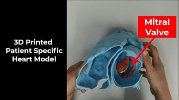 TEER Simulation: Structurally Normal Anatomy