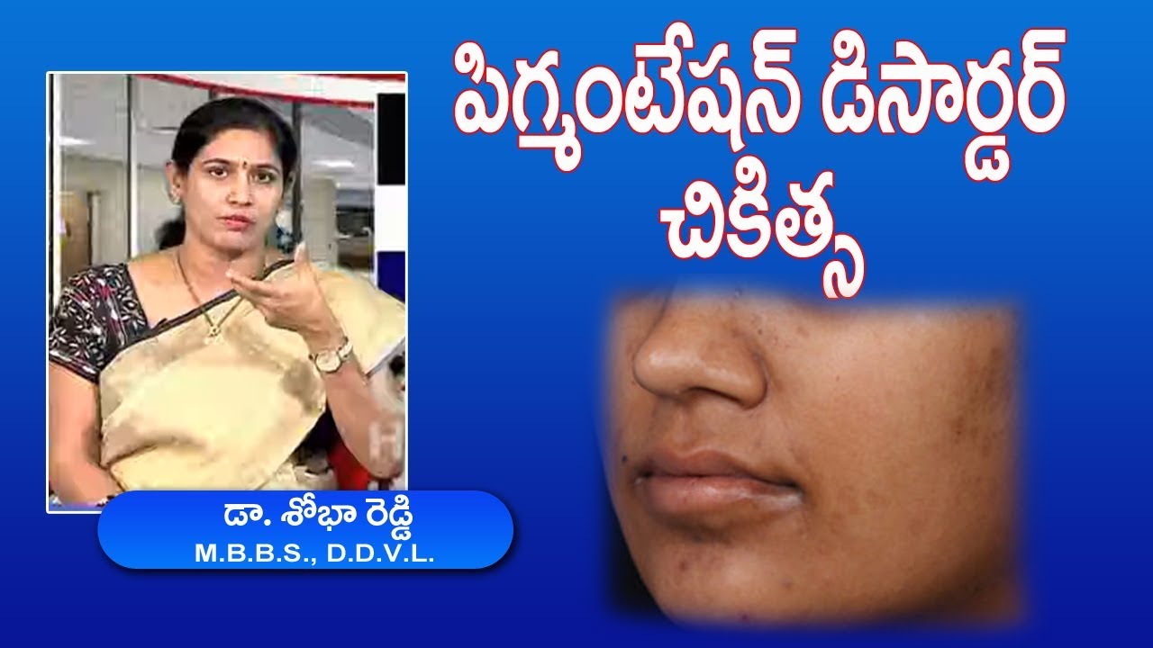 LIVE: What is Pigmentation By Dr. Shobha Reddy |Skin Pigmentation Disorders|Treatment,types & causes ayurvedic medicines in hindi