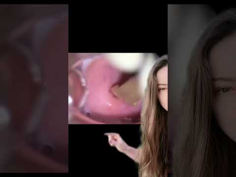 Vídeo: Quem inventou os estribos de ginecologia?