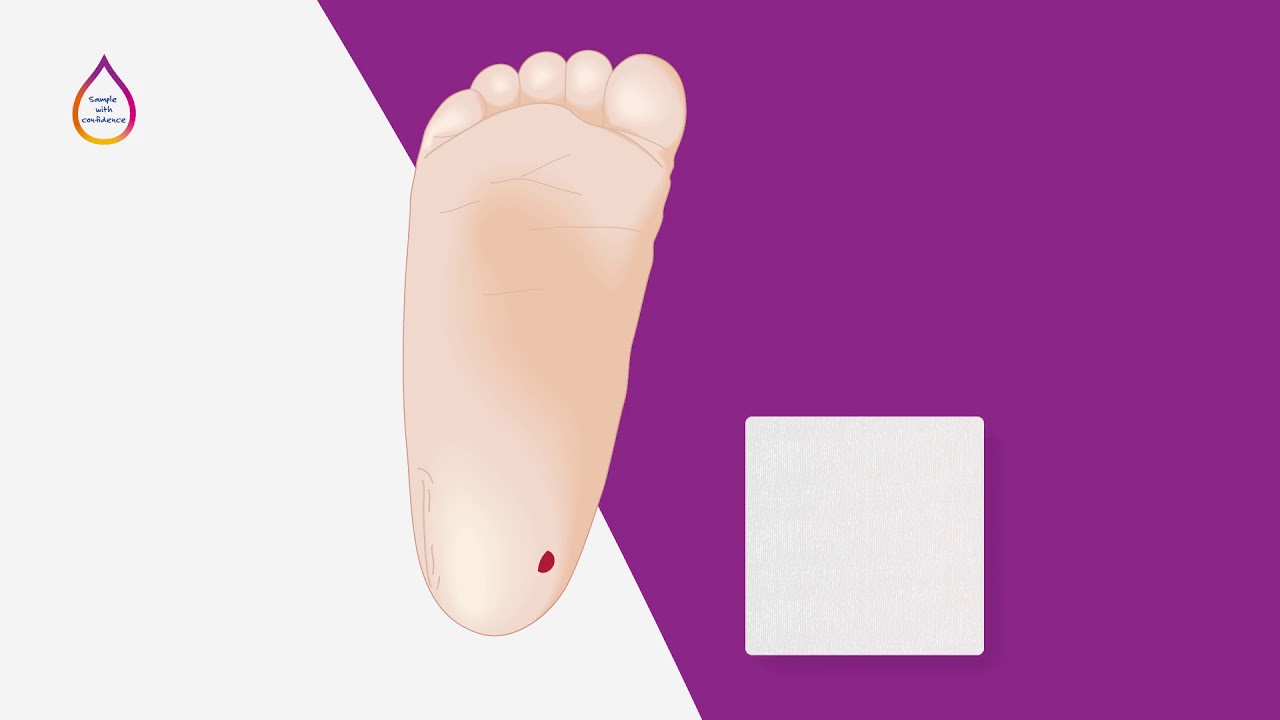 Unistik Heel- Preparation for heel sampling MANDARIN