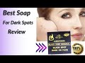 K brothers black soap review  for dark spots and blemishes